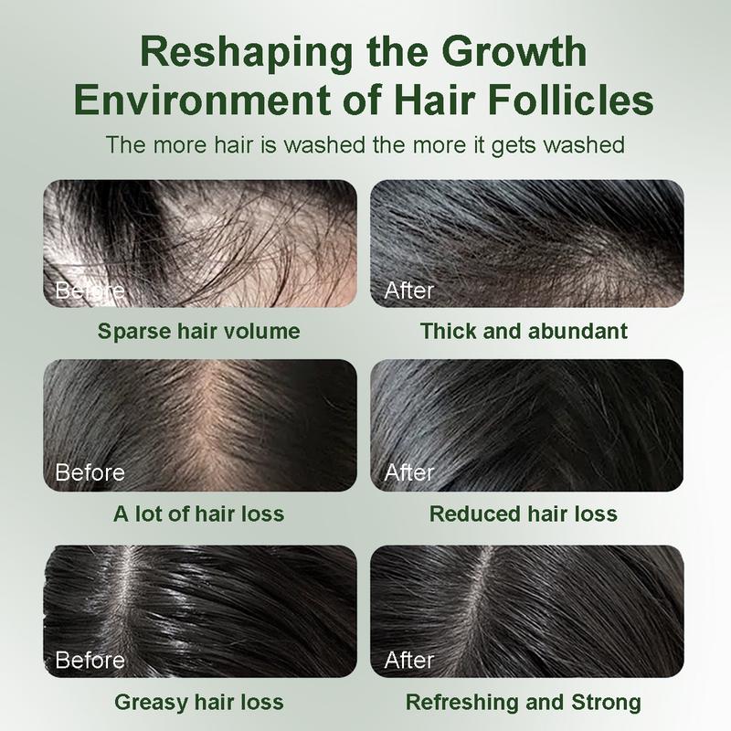 BANKIT Rosemary & Batana Oil ShampooBoostHair Growth, Control Oil & DandruffSootheScalp lritation & RestoreShine!