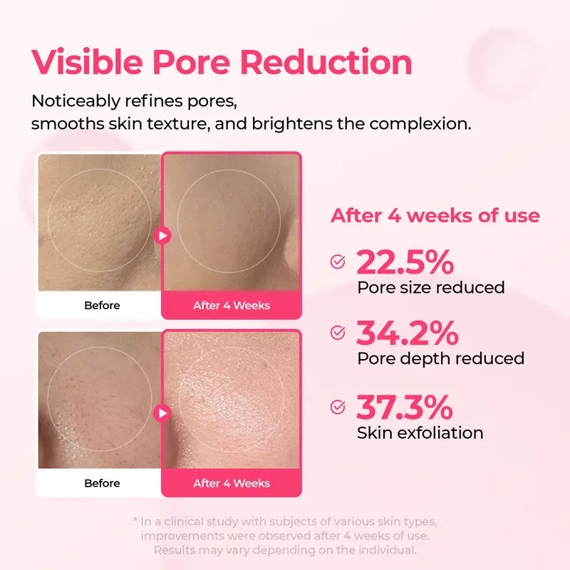 Lumi Pore & Spot Care Duo | Shrinks Pores & Fades Blemish Marks | Cyano Pink Spicule Serum + Picotonic Shot Ampoule