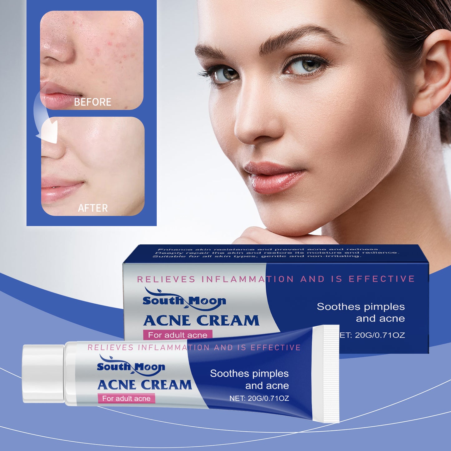 SOUTH MOON Acne Cream