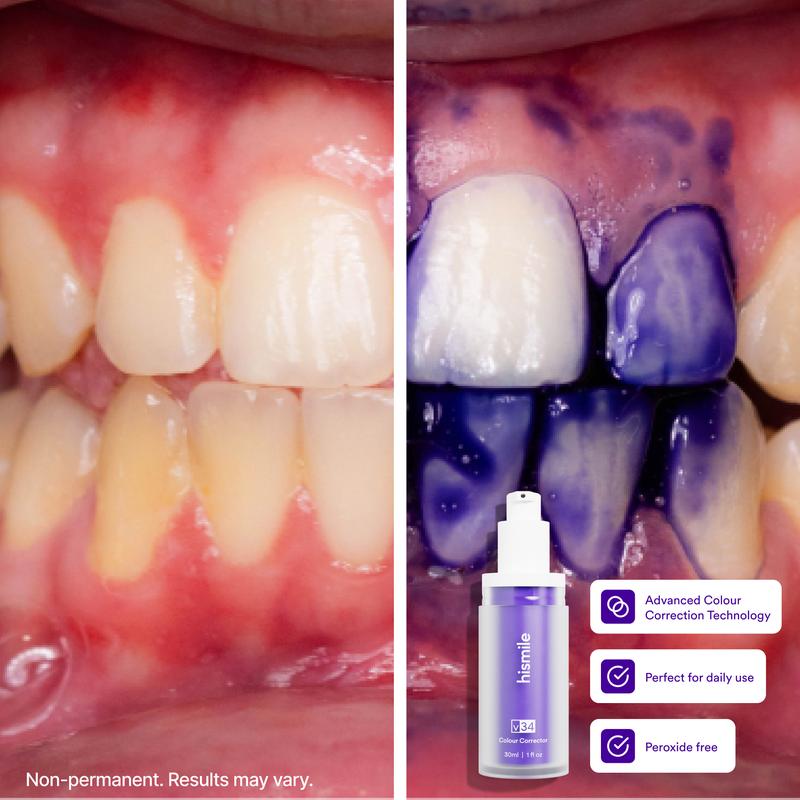 Hismile v34 Colour Corrector - Tooth Stain Concealer, Teeth Brightening Booster, Purple Toothpaste, Colour Correcting, Hismile V34