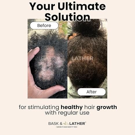 Bask & Lather Scalp Stimulator Hair Growth Oil, Cold Pressed Mint and Rosemary Blend with Grapeseed for Hair Growth, Organic Natural Leave in, All Hair Types, 2 Fl Oz—XDX