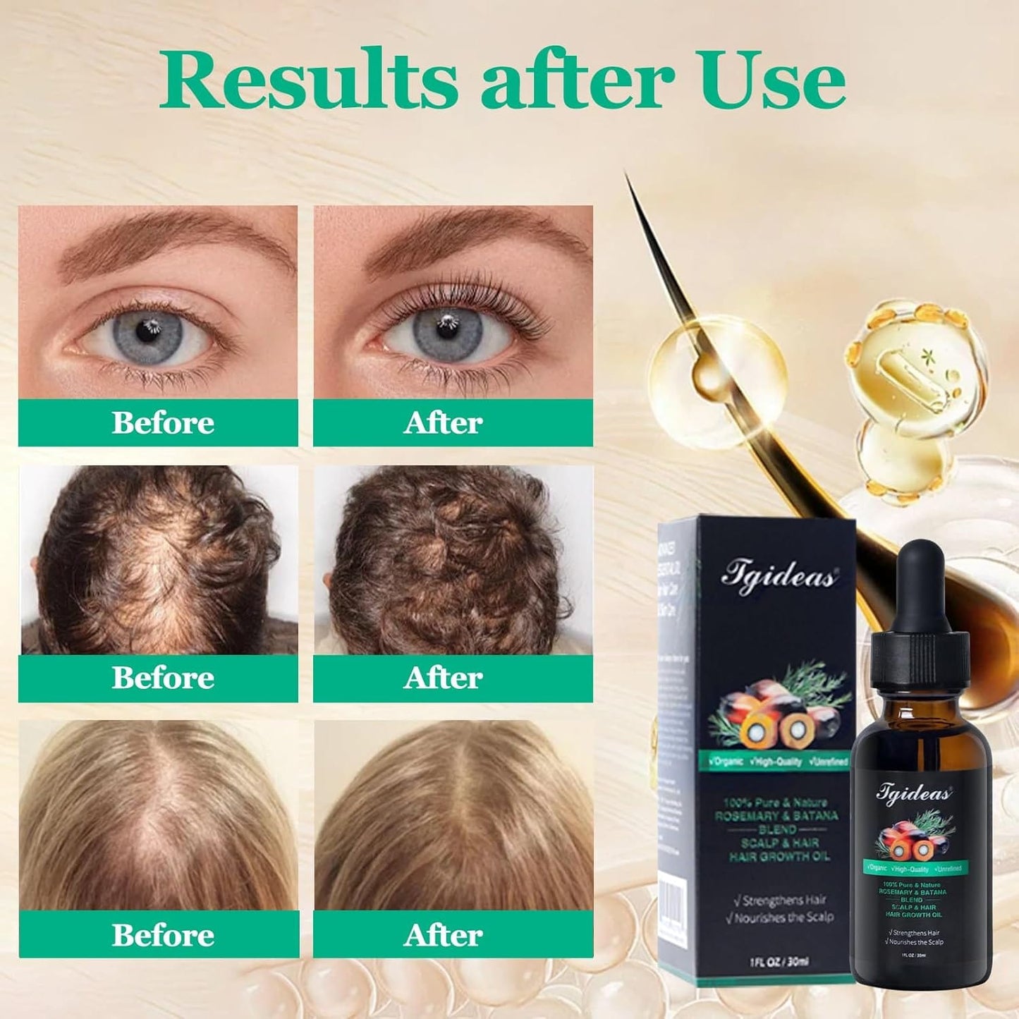Rosemary Batana Oil - Organic Hair Growth -for Scalp & Hair Strengthening - All Hair Types Treatment Oil - Eyebrow & Eyelash Nourishing—HHW