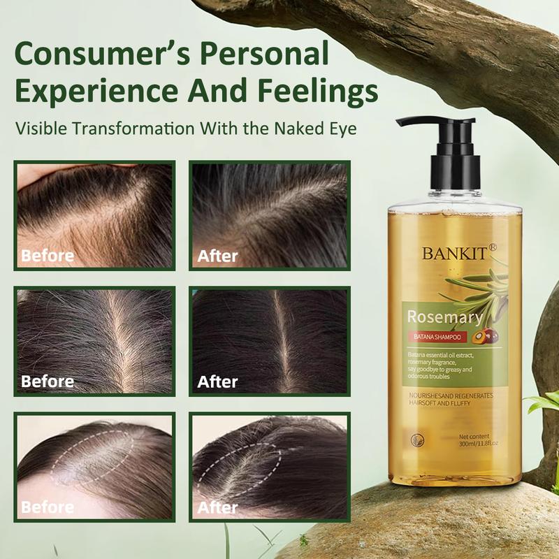 BANKIT Rosemary & Batana Oil ShampooBoostHair Growth, Control Oil & DandruffSootheScalp lritation & RestoreShine!
