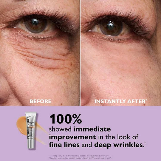 Peter Thomas Roth Instant FirmX Easy Wear Temporary Eye Tightener——XDX