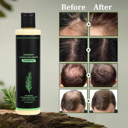 Organic Rosemary Hair Growth Shampoo-Grow thick hair-ZHP