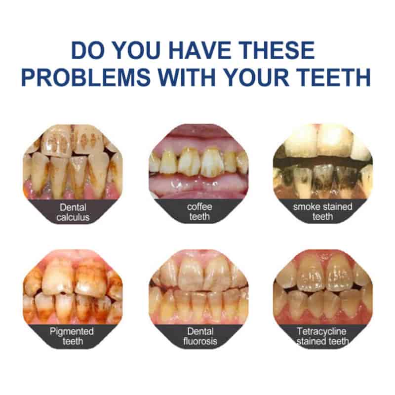 BBOJITM Fluoride-Free Hydroxyapatite Toothpaste - Gentle Whitening & Enamel Strength for Sensitive Teeth