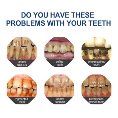 BBOJITM Fluoride-Free Hydroxyapatite Toothpaste - Gentle Whitening & Enamel Strength for Sensitive Teeth