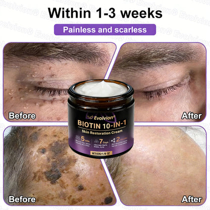 Biotin 10-in-1 Skin Restoration Cream