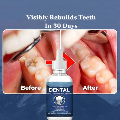 Heroiy™ Advanced Enamel Repair & Whitening Kit (Includes Free LED Mirror)