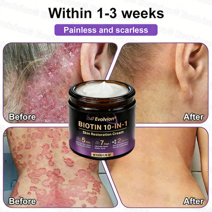 Biotin 10-in-1 Skin Restoration Cream