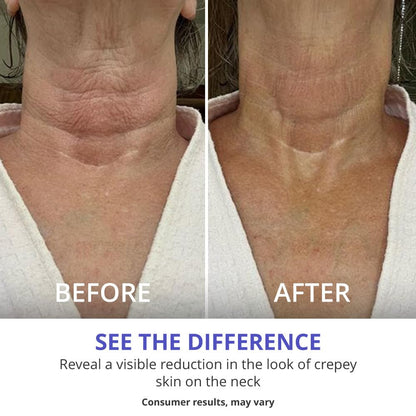 Neck Cream - Tighten & Lift Firming Neck Cream for Crepey Skin