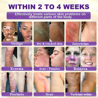 Biotin 10-in-1 Skin Restoration Cream