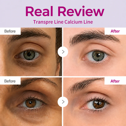 🔥LAST DAY 50% OFF!!Transpre™ Korean Calcium Dark Spot Eye Cream