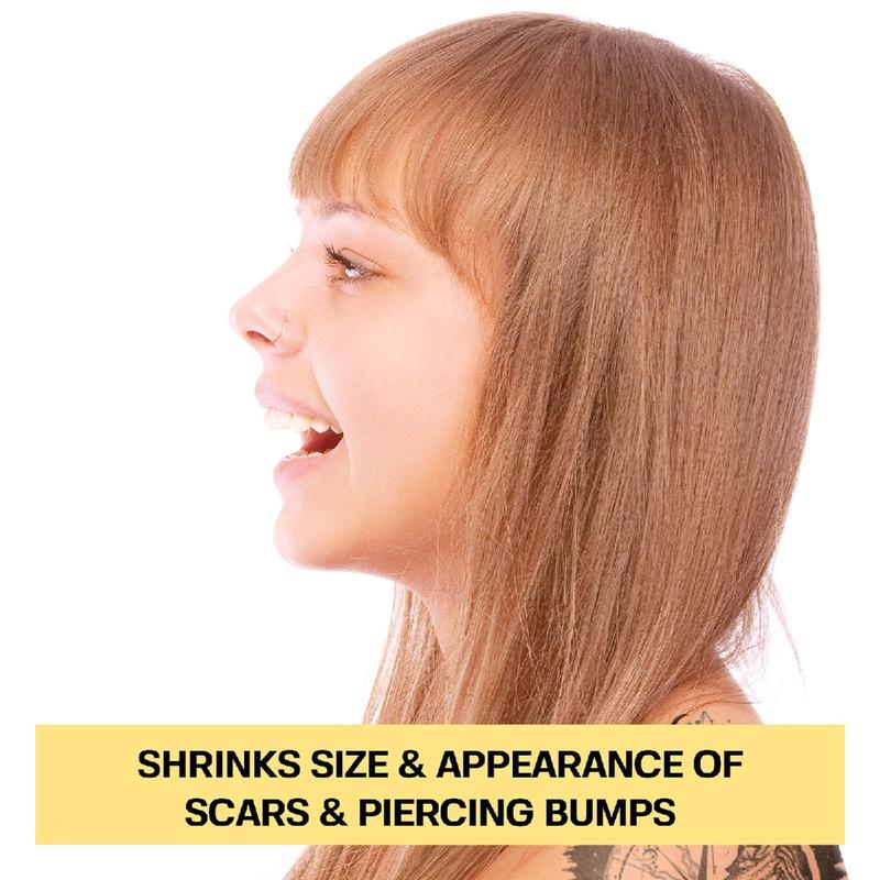 Base Labs Piercing Bump Solution I Keloid Bump Removal - Soothing Essential Oil for Piercing Bumps, Keloids & Scars | Nose, Ears, Body - 15ml