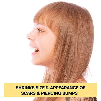 Base Labs Piercing Bump Solution I Keloid Bump Removal - Soothing Essential Oil for Piercing Bumps, Keloids & Scars | Nose, Ears, Body - 15ml