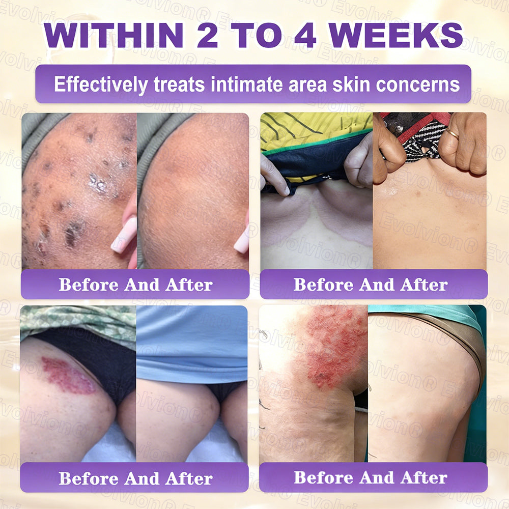 Biotin 10-in-1 Skin Restoration Cream