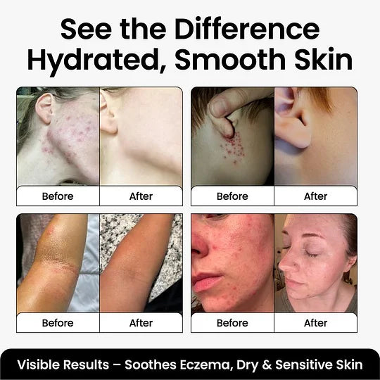 Whipped Tallow Body Butter by Cattle Creek - Deep Moisturizing, Skin Soothing & Repairing Cream Body Care Moisturizer