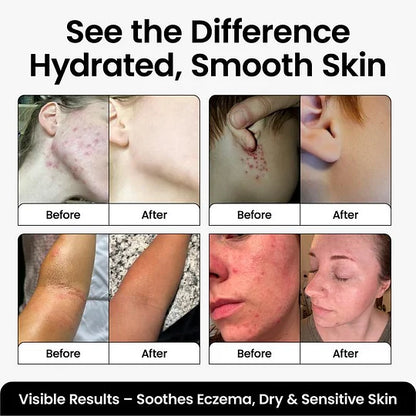 Whipped Tallow Body Butter by Cattle Creek - Deep Moisturizing, Skin Soothing & Repairing Cream Body Care Moisturizer