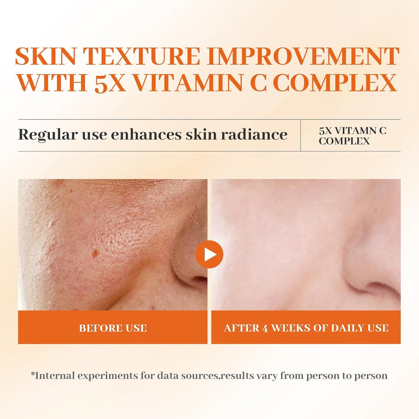 SADOER 5x Vitamin Face Toner/Glass skin/Collagen+HyaluronicAcid+Niacinamide
