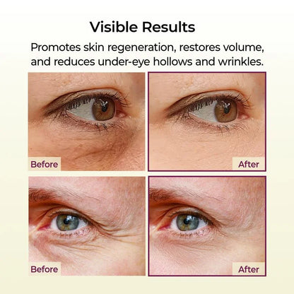 Calcium Volume Multi Balm+Eye Patch 60ea Korean Cosmetics with Collagen Extract Elasticity