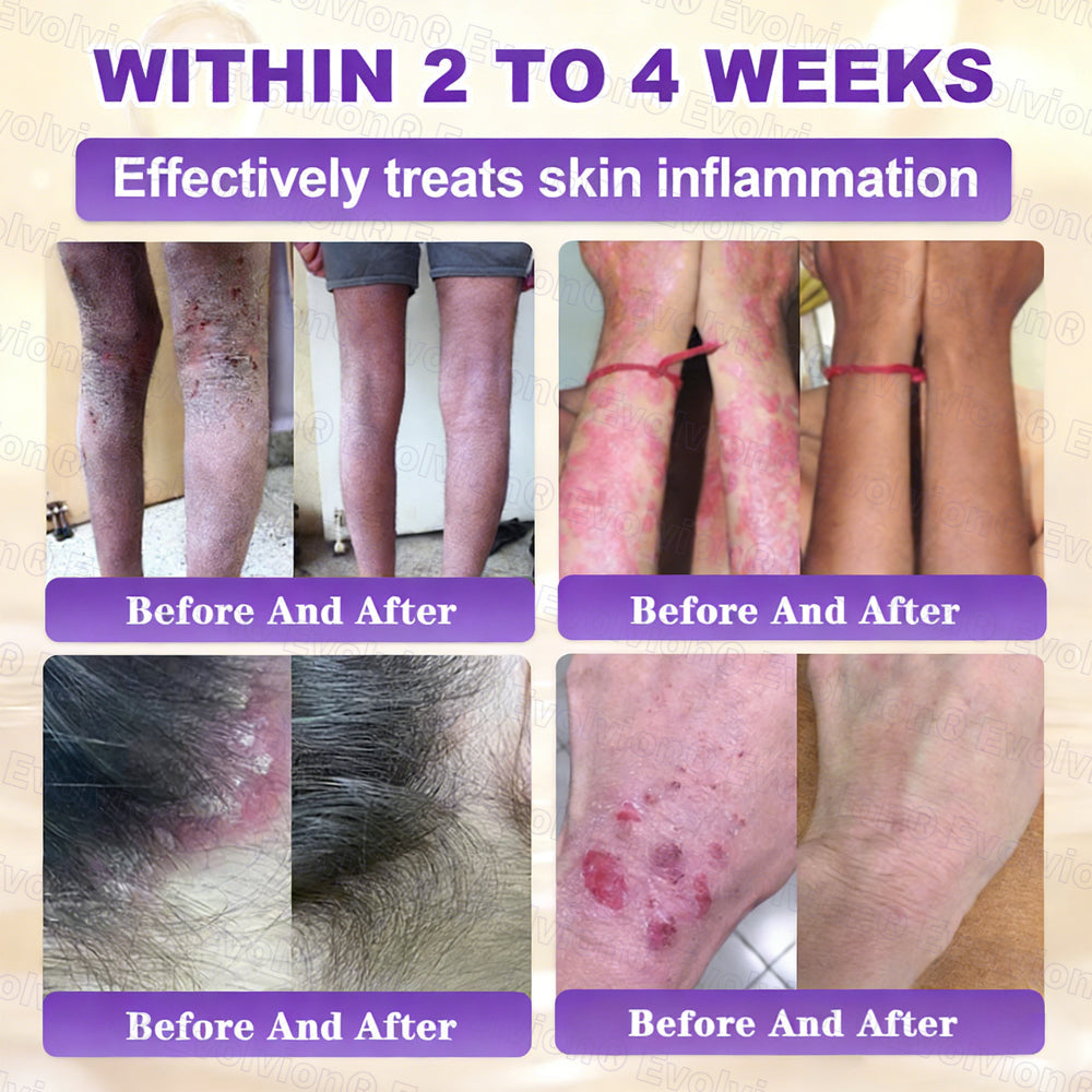 Biotin 10-in-1 Skin Restoration Cream