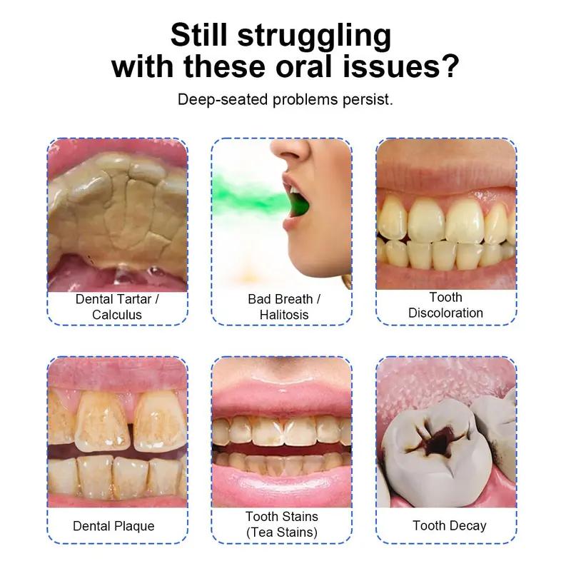 NBGRLVS Electric Scaler/Oral Plaque/Tartar Remover with Effective Remove Plaque Tartar and Stains Preventing Cavities Bad Breath and Gum Disease for At-Home Teeth Cleaning Cost-Effective Oral Care Solution - Cleansing