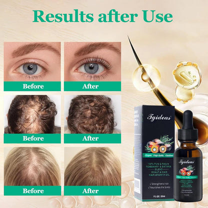 Rosemary Batana Oil - Organic Hair Growth -for Scalp & Hair Strengthening - All Hair Types Treatment Oil - Eyebrow & Eyelash Nourishing—HHW
