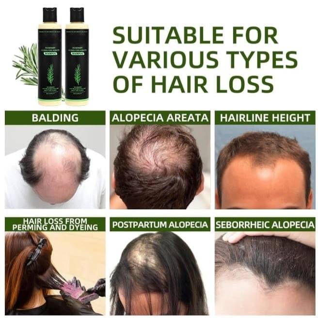 Organic Rosemary Hair Growth Shampoo-Grow thick hair-ZHP