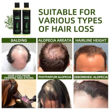 Organic Rosemary Hair Growth Shampoo-Grow thick hair-ZHP