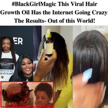 BASK AND LATHER Scalp Stimulator Hair Growth Oil - Lightweight Rosemary & Mint Blend for Thicker, Fuller Hair, Alopecia Support & Hair Regrowth