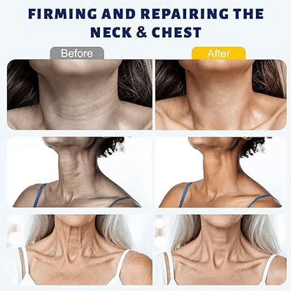 ✨ Nexdrivo™ Instant Neck Lift Cream  — 🧴 Infused with Retinol & Hyaluronic Acid | Firms the Neck, Reduces Wrinkles & Double Chin