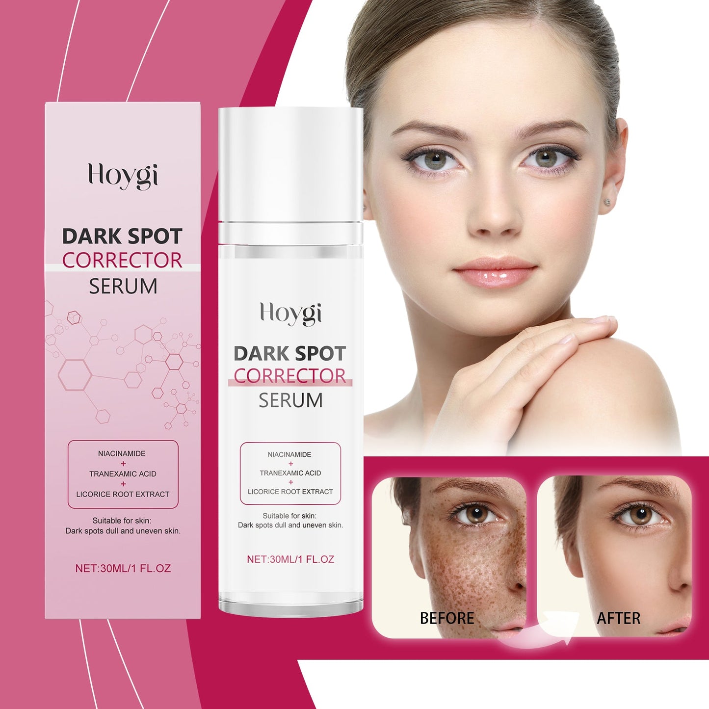 Advanced Dark Spot Corrector Serum - Multi-Correction Brightening Formula for Sun Spots, Age Spots, and Melasma-XXS