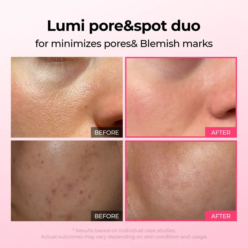 Lumi Pore & Spot Care Duo | Shrinks Pores & Fades Blemish Marks | Cyano Pink Spicule Serum + Picotonic Shot Ampoule