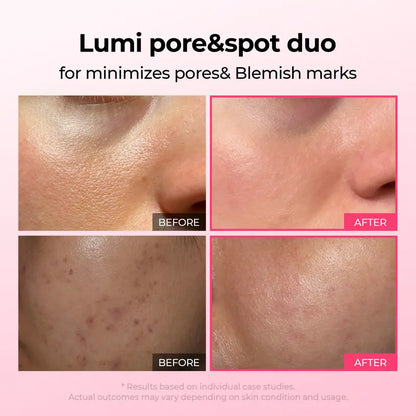 Lumi Pore & Spot Care Duo | Shrinks Pores & Fades Blemish Marks | Cyano Pink Spicule Serum + Picotonic Shot Ampoule
