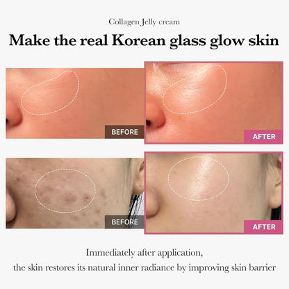 [Exclusive SET] Korean Home Aesthetic Duo l Experience Glass Glow Effect with Zero Exosome Spicule Serum + Collagen Niacinamide Jelly Cream Combination