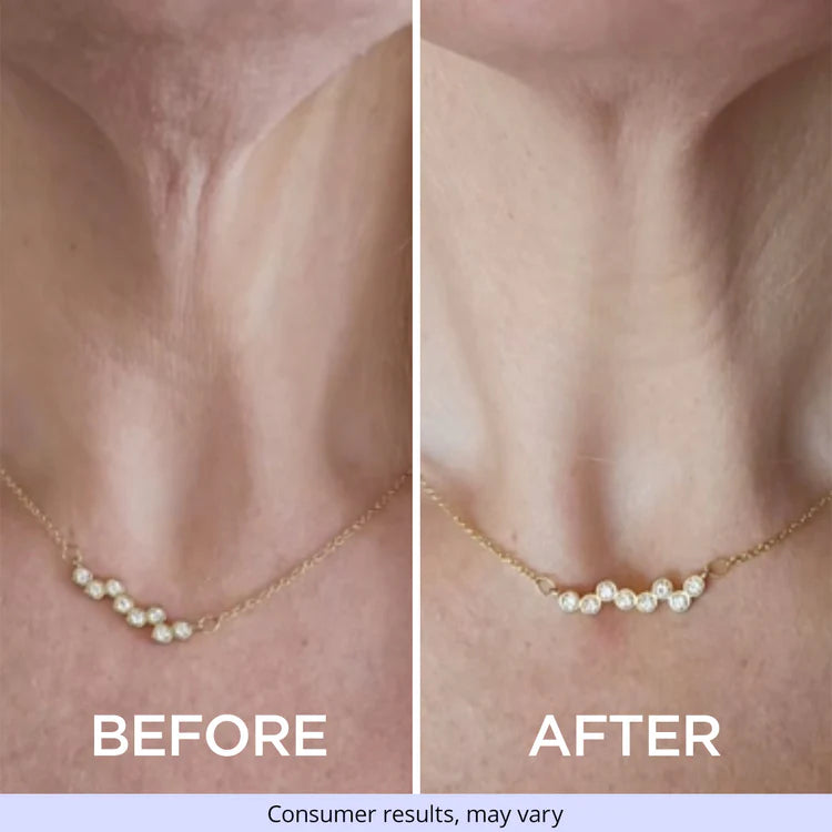 Neck Cream - Tighten & Lift Firming Neck Cream for Crepey Skin