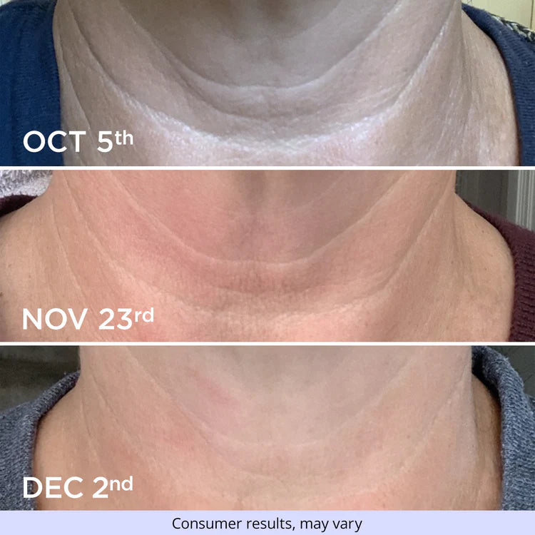 Neck Cream - Tighten & Lift Firming Neck Cream for Crepey Skin